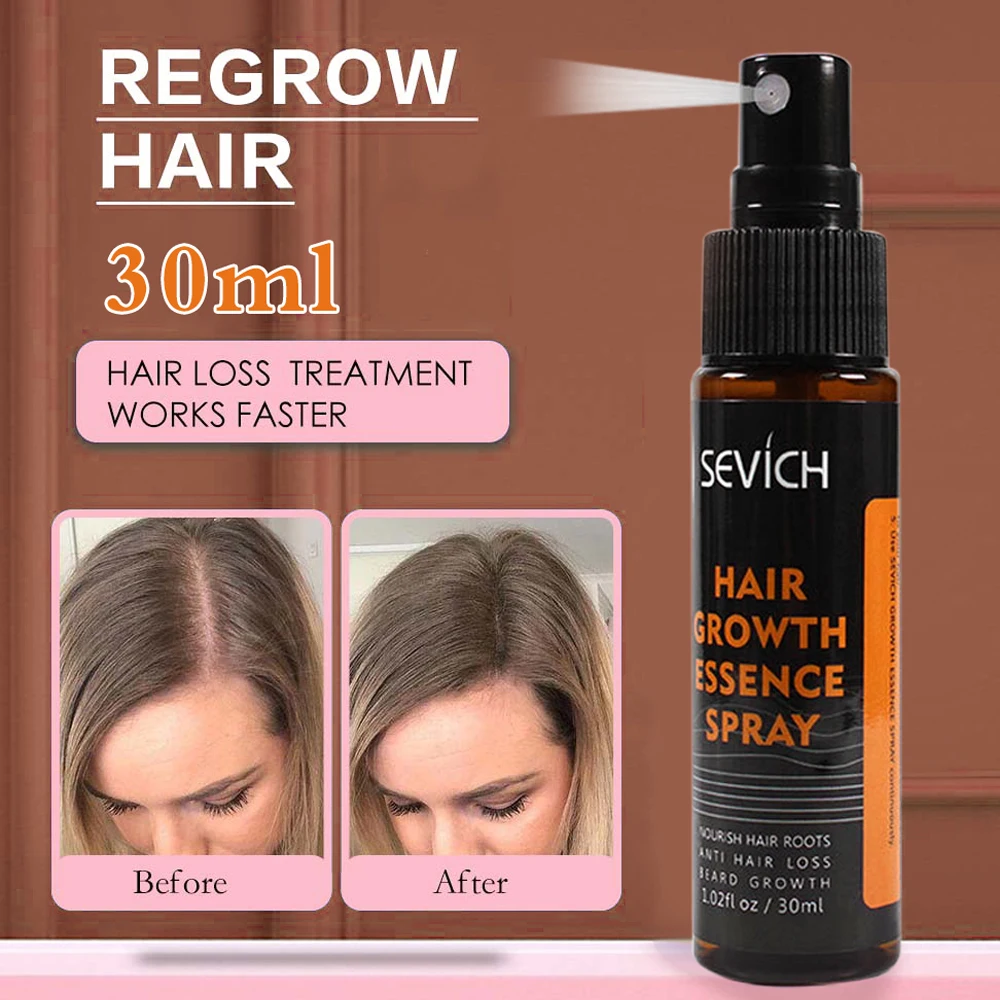 

Anti Hair Loss Products Hair Growth Spray Essential Oil Liquid for Men Women Hair Growth Essence Serum Hair Care Repair Growing