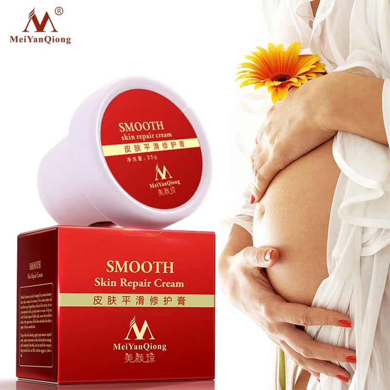 MeiYanQiong драгоценный крем для тела для кожи, средство для удаления растяжек и шрамов, мощный крем для лица после родового ожирения и беременности