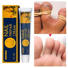 

Effective Foot Treatment Cream Anti Fungal Infection Onychomycosis Paronychia Athletes Toe Fungus Antibacterial Repair Ointment