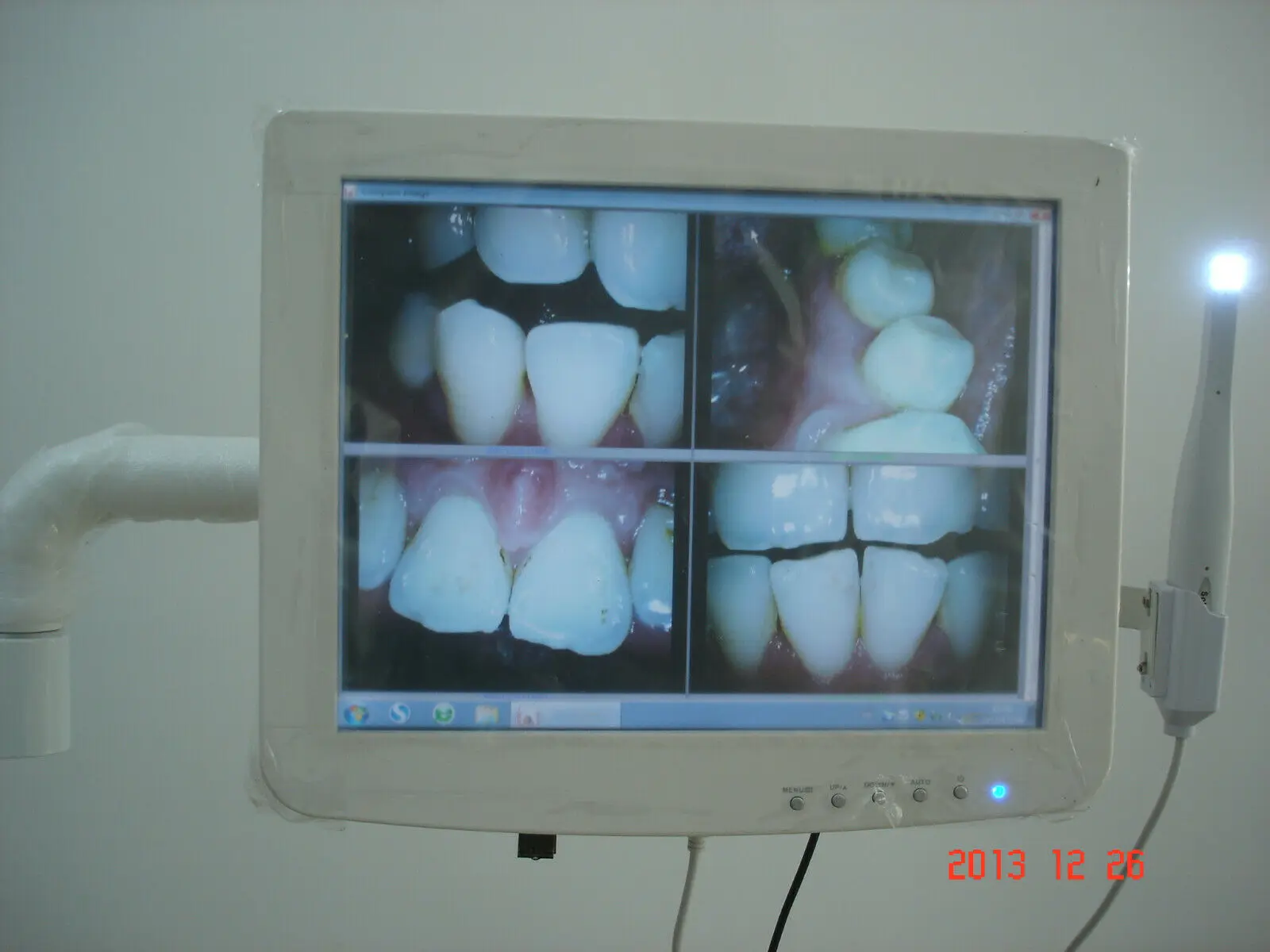  High Quality Dental Touch screen capacitive monitor with intraoral camera built in Intel/Windows10
