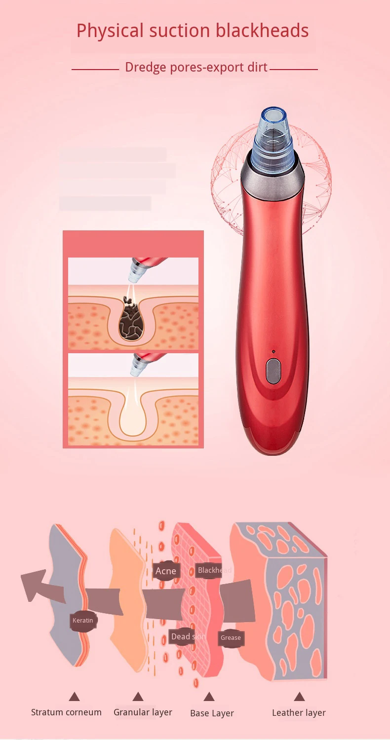 Removedor de Cravo Poros Limpeza Sugar Acne Graxa Melhorar Horny Cupping Massagem Aspirador Preto Dot Espinha Removedor Ferramenta 3d 12 Beleza e saúde