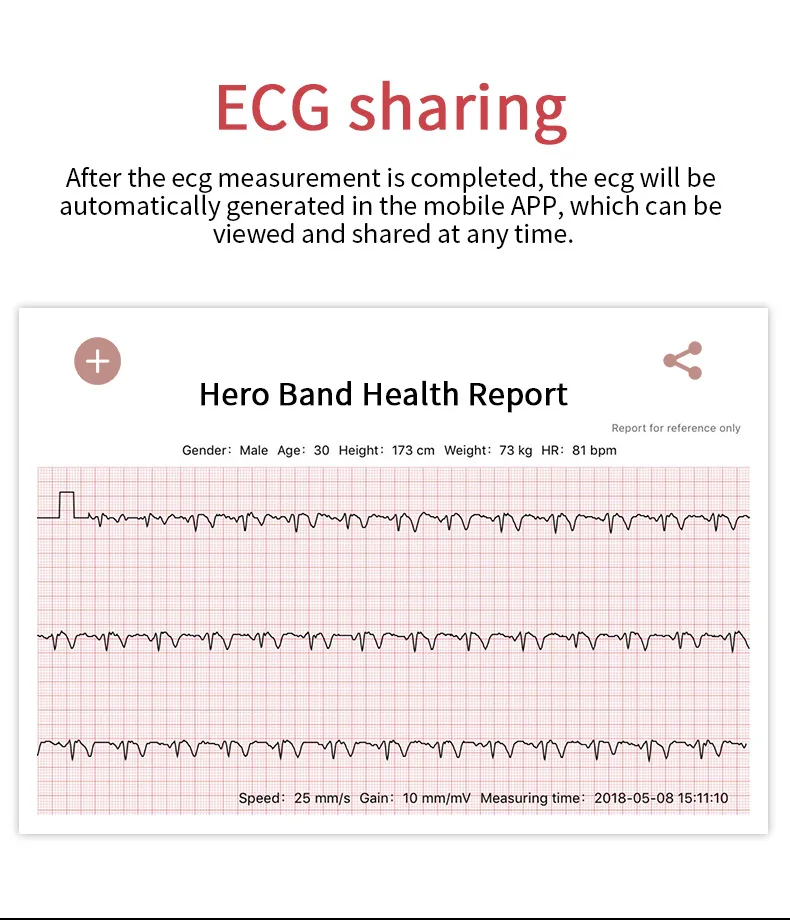 B79 Smart Watch Women PPG+ ECG ladies Smart Bracelet Heart Rate Monitor Blood Pressure Call reminder Smart Wristband