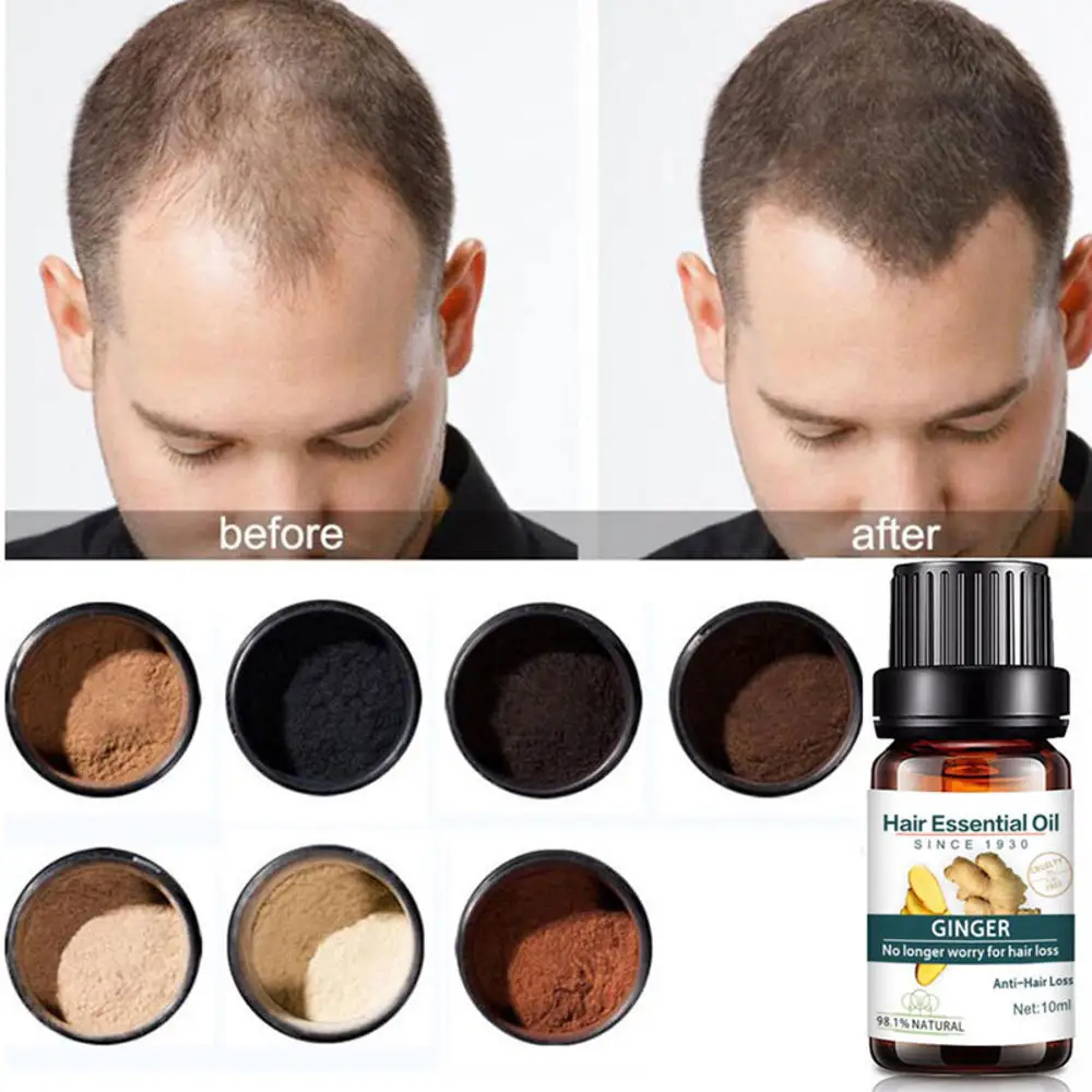 10ml Ginger Hair Essential Oil Hairdressing Hair Mask Plant Extract Essential Oil Dry and Damaged Treatment Hair Nutrition Hair 10ml Ginger Hair Essential Oil Hairdressing Hair Mask Plant Extract Essential Oil Dry and Damaged Treatment Hair Nutrition Hair