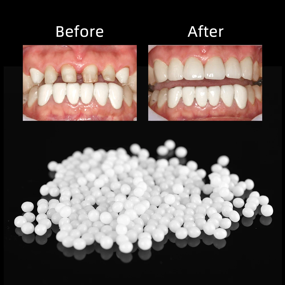 100 г набор для ремонта зубов и зубных Зубцов, твердый клей для зубных протезов, клей для зубных зубов, зубные зубы из смолы, твердый клей, Временный