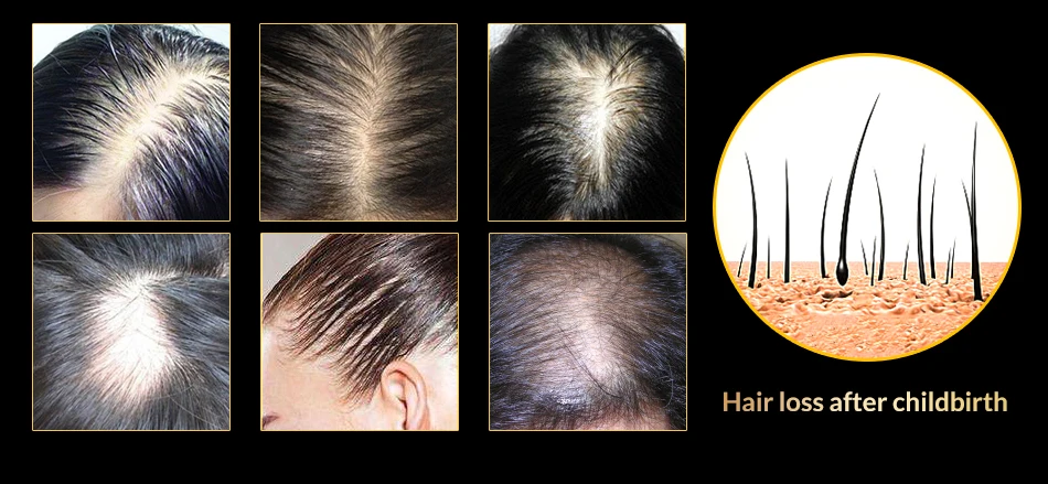 Hfea06d2806e843599492e0416032a54a5