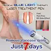 Heath Blue Light Therapy Varicose Veins Treatment Laser Pen Soft Scar Wrinkle Removal Treatment Acne Laser Pen Massage Relax ► Photo 1/6
