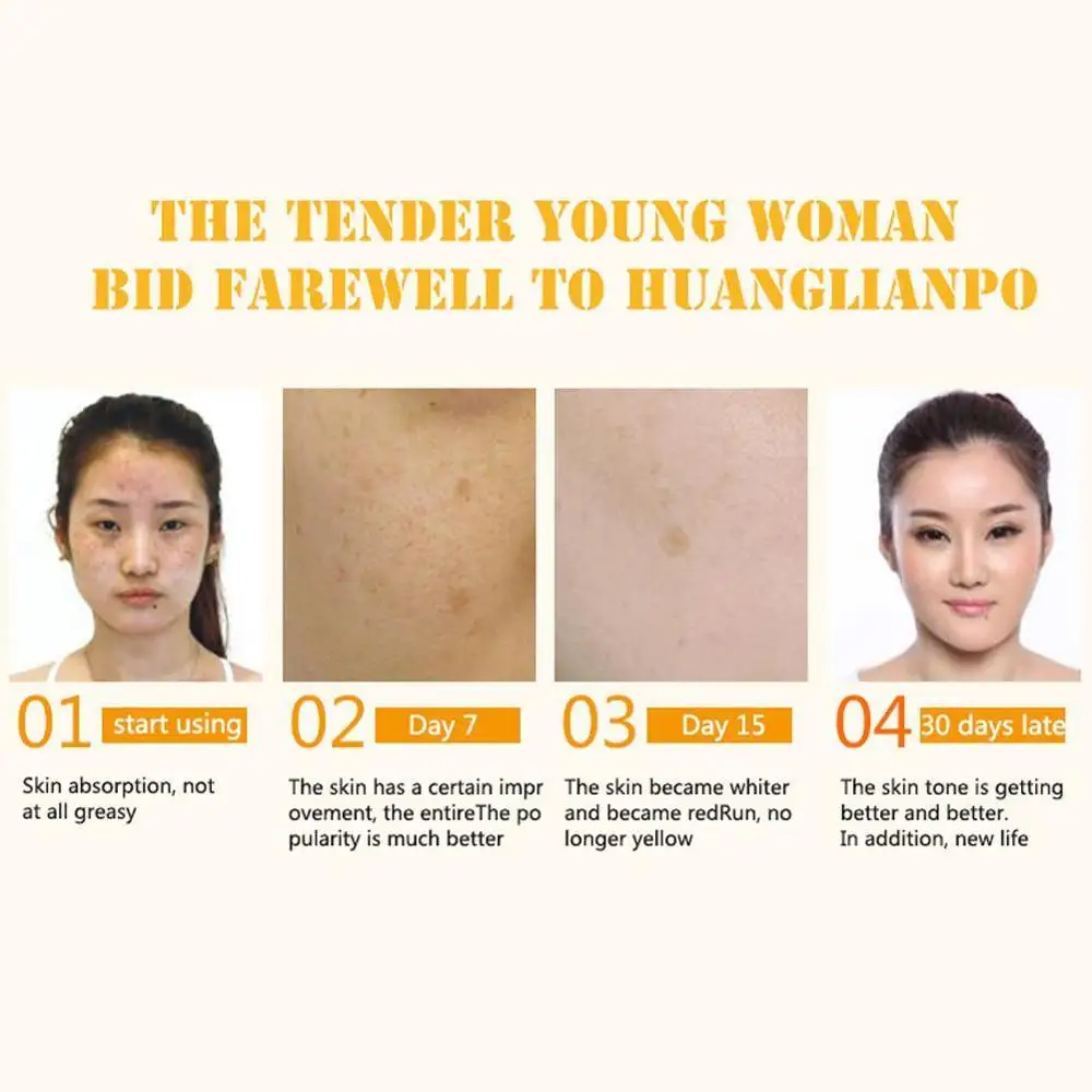 100% Pure Vitamin C Serum Liquid Freckle Removal Acne Scar Hyaluronic Acid Anti-wrinkle Vc Face Serum Oil Fade Dark Spot Essence 100% Pure Vitamin C Serum Liquid Freckle Removal Acne Scar Hyaluronic Acid Anti-wrinkle Vc Face Serum Oil Fade Dark Spot Essence
