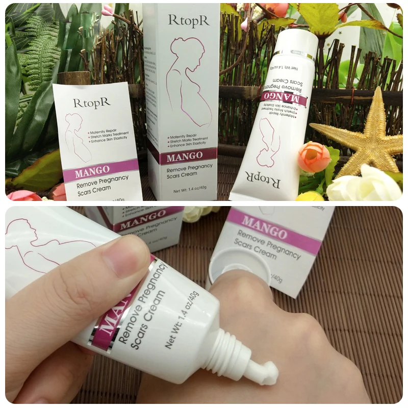 Pregnancy Scars Acne Cream Maternity Repair Anti Winkles Stretch Marks Treatment Natural Mango Extract Firming Body 3