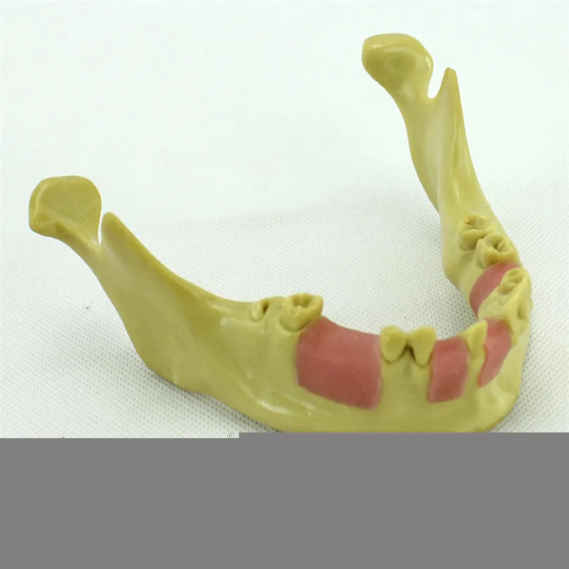 

Dental Implant Teeth Practice Model Anatomical Lower Jaw Mandibular Model For Medical Dentist Demonstration Teaching Training