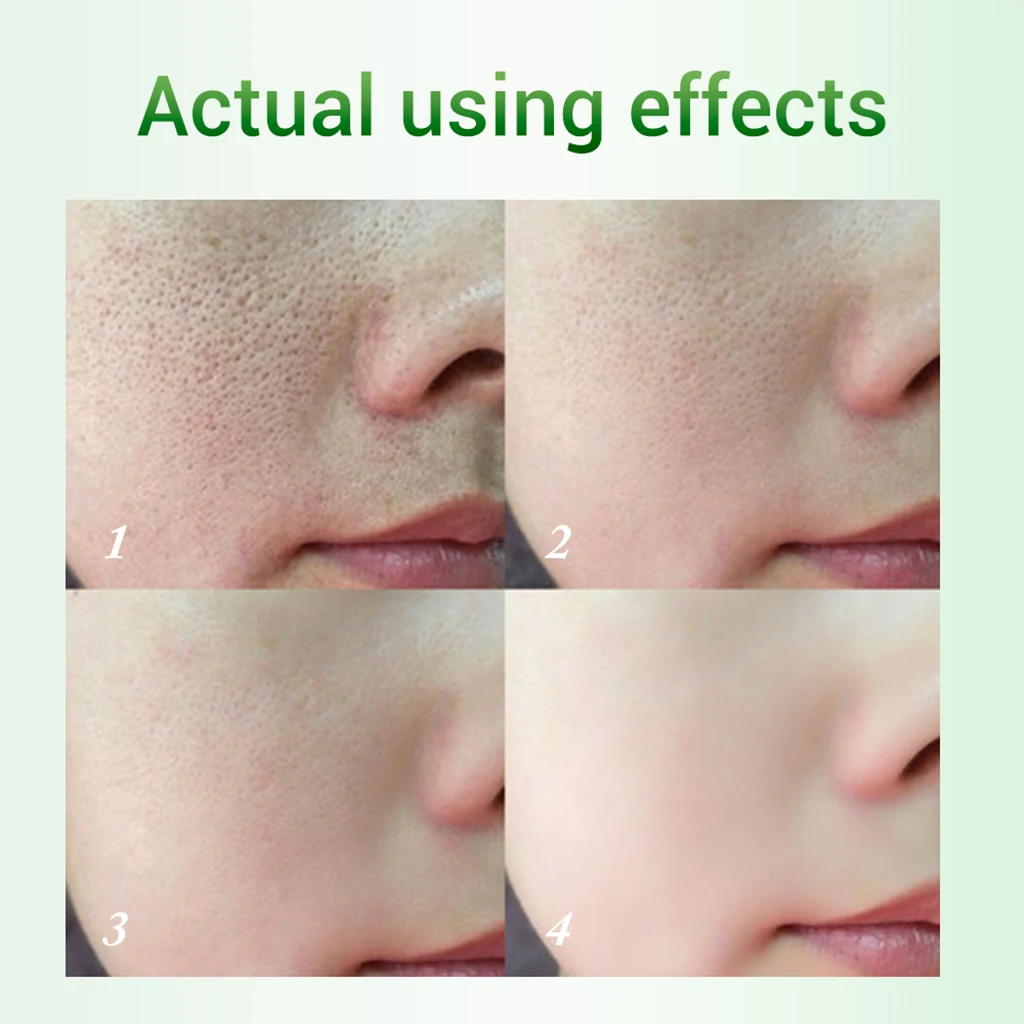 BREYLEE Shrink Pores Serum Pore Tightens Refining Moisturizing Essence Whitening Anti-aging Oil Control Facial Essence Skin Care