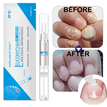 

1pcs 3ml Anti Fungal Treatment Nail Pen Onychomycosis Paronychia Herbal Toe Finger Nails Health Beauty 2019 New TSLM1