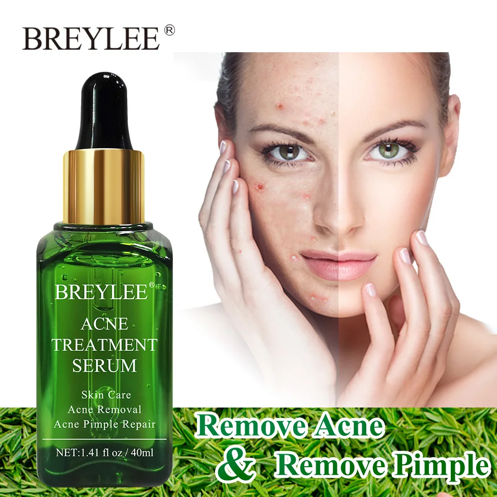 Breylee Acne Treatment Serum 40ml Face Facial Essence Anti Acne Scar Removal Cream Skin Care