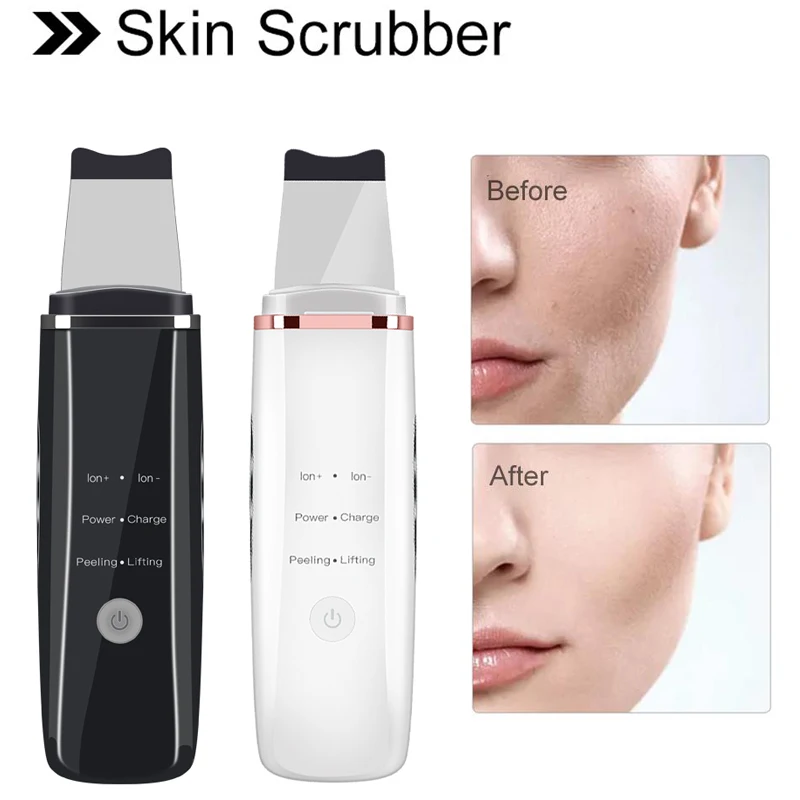 

Ultrasonic Skin Scrubber Deep Face Cleaning Machine Peeling Shovel Facial Pore Cleaner Ion Acne Exfoliating Blackhead Remover