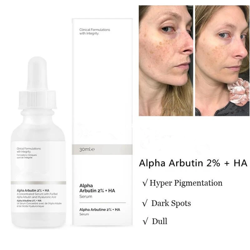 Lowered Skin-Smooth Face-Skin-Make Alpha Arbutin Ordinary Moisturized Dark-Spots Brighten 2%Essencelighten-Improve VRM8AyY0JZa