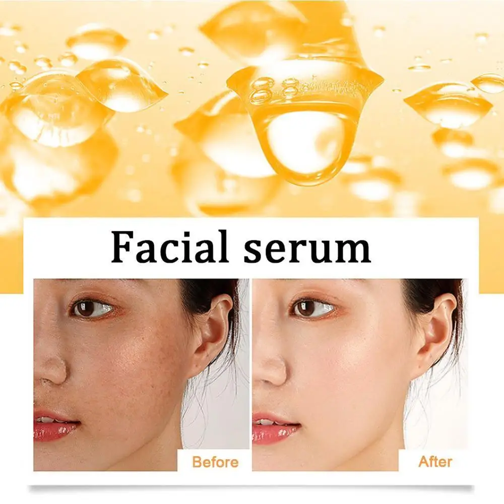 30ML Pure Vitamin C Serum Liquid Freckle Removal Acne Scars Hyaluronic Acid Anti-wrinkle Vc Face Serum Fade Dark Spot 30ML Pure Vitamin C Serum Liquid Freckle Removal Acne Scars Hyaluronic Acid Anti-wrinkle Vc Face Serum Fade Dark Spot