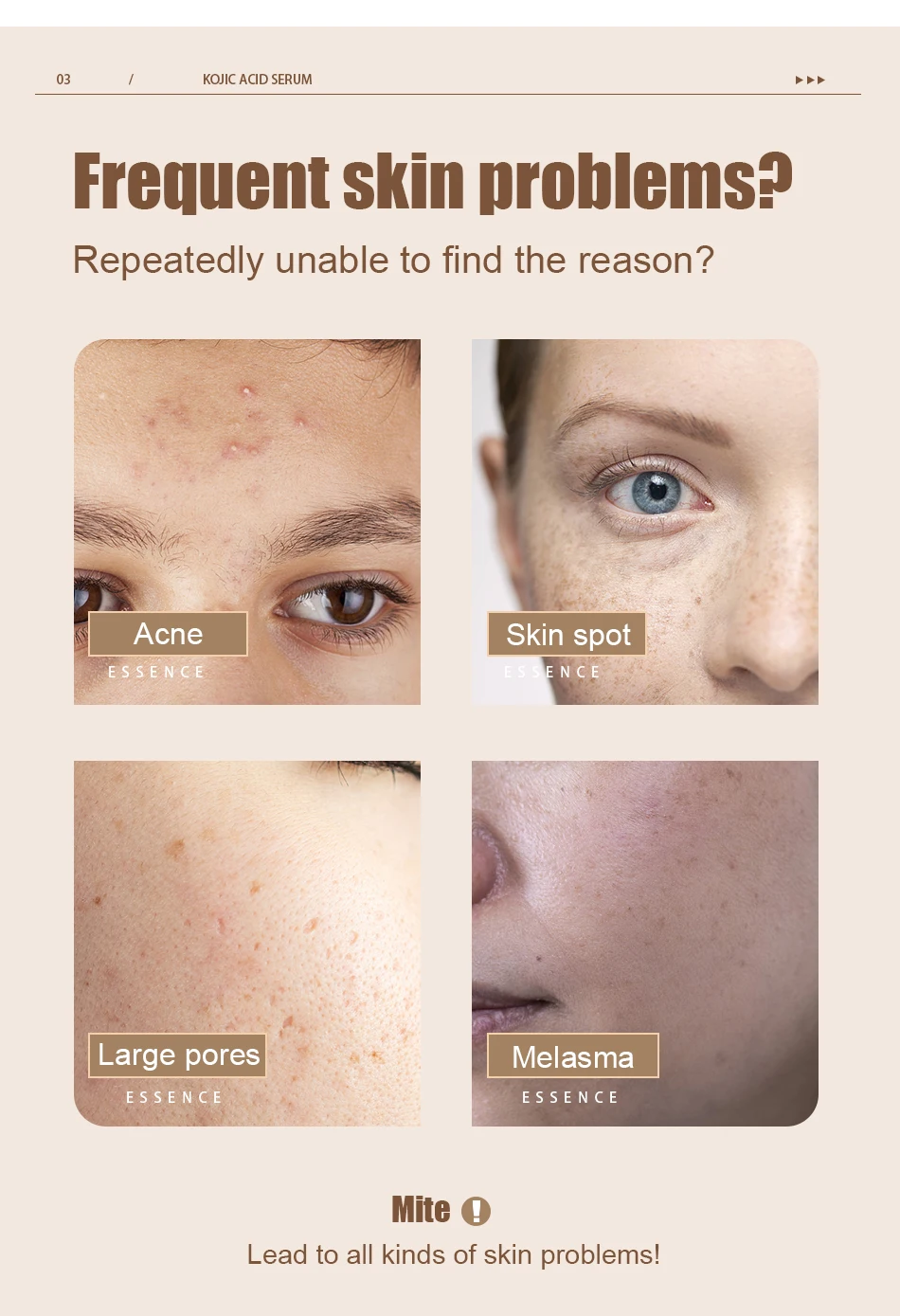 Sardas, Melasma, Pigmento Melanina, Queimadura Solar, Acne, Scars, Mancha Escura