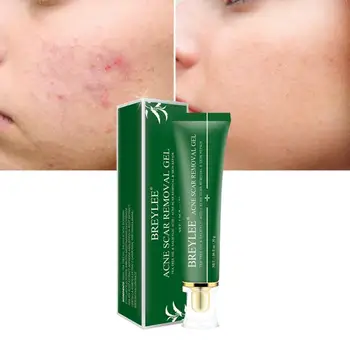

New 1pc 30g Acne Scar Removal Gel Fade Marks Spots Remove Skin Pigmentation Soothing Prevent Acne Treatment Serum Essence TSLM1