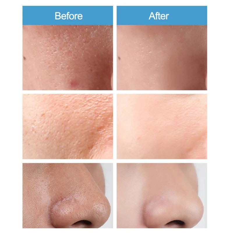 Pores Shrinking Essence Moisturizing Oil-Control Brighten Skin Color Pore Convergence Essence