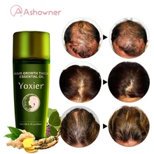 

Fast Hair Growth Ginger Essential Oil Effective Moisturizing Hair Care Serum Anti-Hair Dry Breaking Loss Scalp Repair Nourish