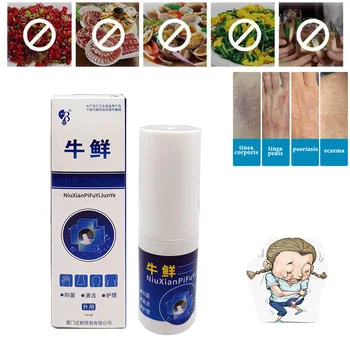 

Chinese Herbal Body Psoriasis Cream Dermatitis Eczematoid Eczema Ointment Skin Psoriasis Treatment Cream