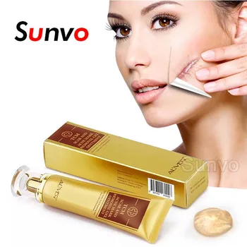 

Cne Scar Stretch Marks Remover Cream Skin Repair Face Cream Acne Spots Acne Treatment Blackhead Whitening Cream Skin Care Insole