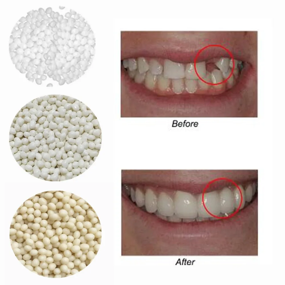 3 Colori Dentali Orali Falsi Denti Finti Riempimento Dei Denti Riparazione Sorriso Snap On Impiallacciature Protesi Custodia Pasta Perline Adesive Set