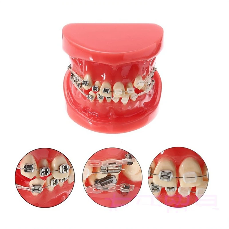 

NSKLED Dental Orthodontic Model Half Ceramic Half Metal Bracket With Anti-nail For Medical Science Disease Teaching Study Dental