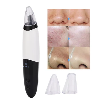 

3-In-1 Electric Face Pore Cleaner Electric Blackhead Removal Instrument Suction Face Care Devices Skin Vacuum Pore Cleaner