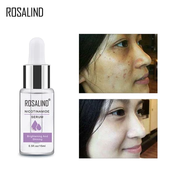 

ROSALIND Niacinamide Facial Serum Wrinkle Whitening Moisturizing Cream Repair Skin Renewing Skin Facial Treatment Essence