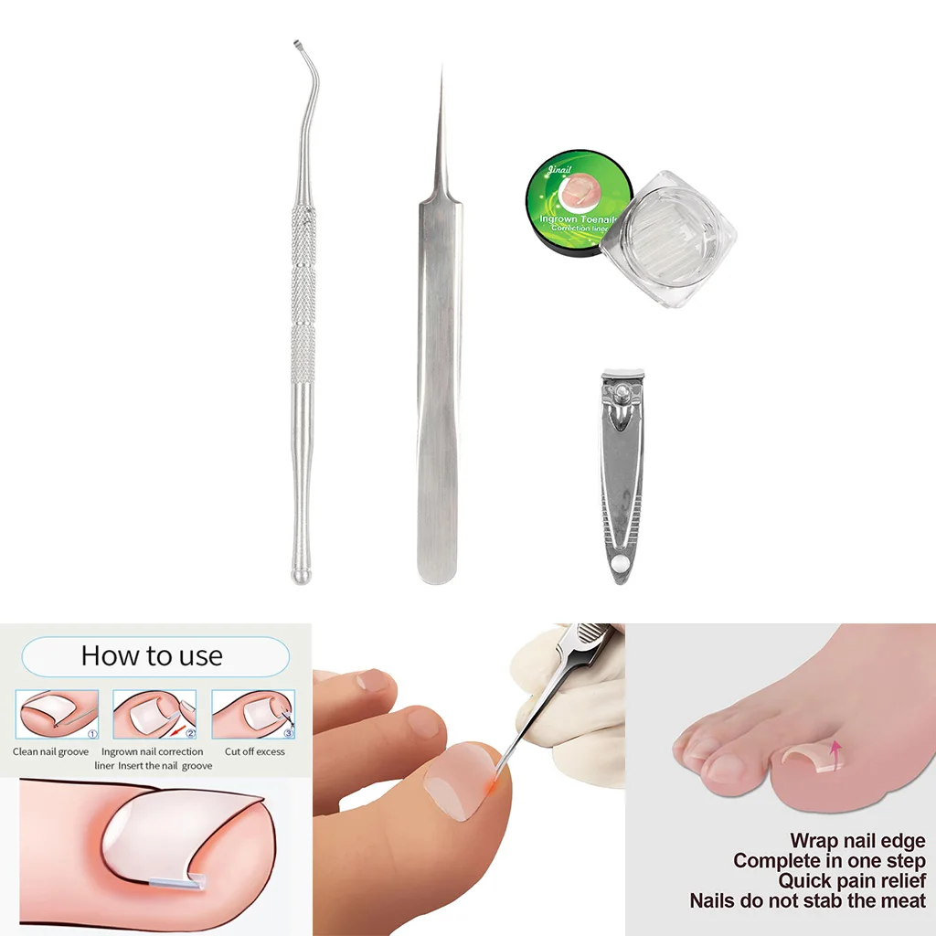 Professional Ingrown Toenail Lifter Correction Tools Toe Nail File Clippers Nail Cleaner Manicure Pedicure Podiatry Tool Professional Ingrown Toenail Lifter Correction Tools Toe Nail File Clippers Nail Cleaner Manicure Pedicure Podiatry Tool