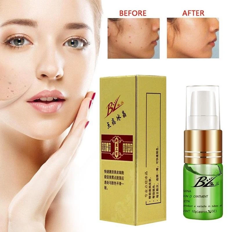 effective dark spot treatment