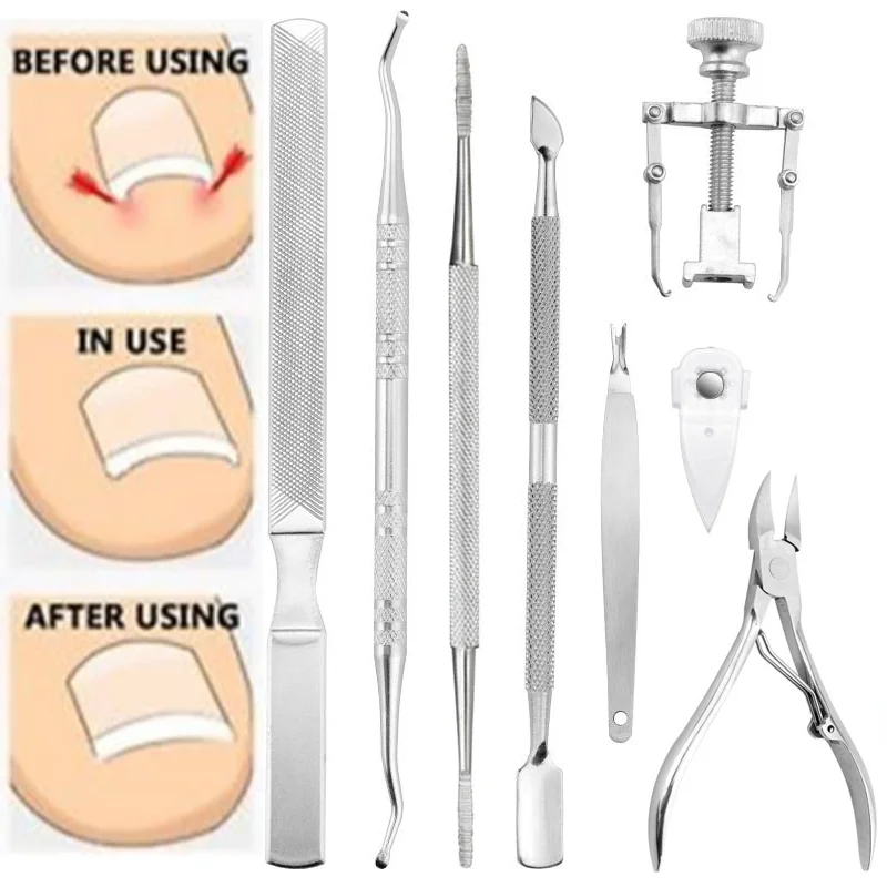 Professional Pedicure Tools Ingrown Toenail Tools Kit Nail Care Ingrown Toenail Removal Correction Clippers Foot Care 5/6/7/8pcs 8pcs set professional foot care kit pedicure tools set stainless steel foot rasp foot dead skin remover clean toenail care kit