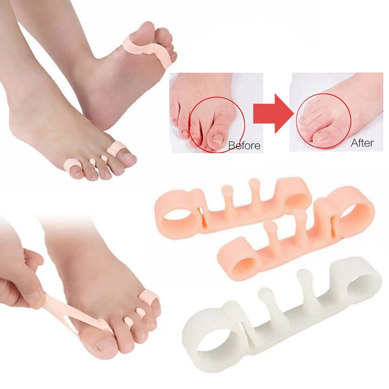 1 Pair Orthotic Toe Separator Straightener Bunion Silicone Flexible Valgus Splint Corrector Ingrown Toenail Tools