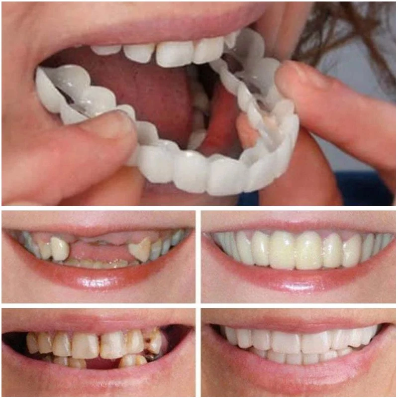 3 шт. имитации зубных протезов верхние зубы нижние зубы коробка держать улыбку комфорт подходит косметические зубные протезы зубы верхний шпон