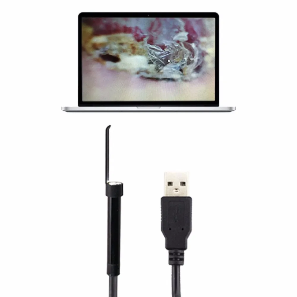 Профессиональный USB HD визуальный эндоскоп для чистки ушей с короткой ручкой, инструмент для чистки ушей из ПВХ, ресинн, Ушная ложка, забота о здоровье, новинка