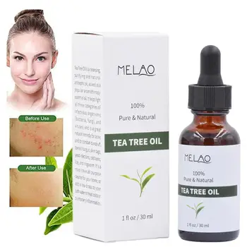 

30ml Pure Tea Tree Essential Oil For Acne Treatment Anti-Wrinkle Grease Hydrating Oil-control Contractive Pore Facial-beauty Oil
