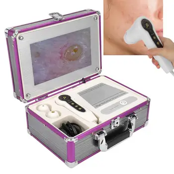 

10.1inch Charging Type Microscope Scalp Hair Follicle Skin Hair Detector Analyser Machine 100-240V