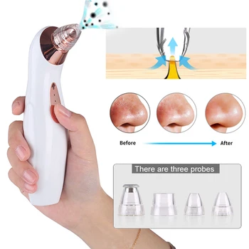 

Household Facial Pore Cleaning Suction Device Electric Blackhead Removal Instrument Remove Blackheads And Acne Pimple Artifacts