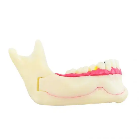  Dental MandibularTeeth Demonstration Anatomical Patient Study Teach Model - 32687309910