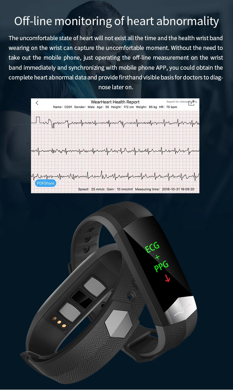 MAAT CD01 Смарт часы ЭКГ+ PPG ЭКГ HRV здоровый сердечный ритм Мониторинг Артериального Давления большие данные облачный сервис Спортивное использование браслет