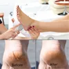 Foot Scraper Pedicure Foot File Callus Remover Stainless Steel Portable Rasp Colossal Foot Grater Scrubber Pro for Wet Dry Feet ► Photo 3/6