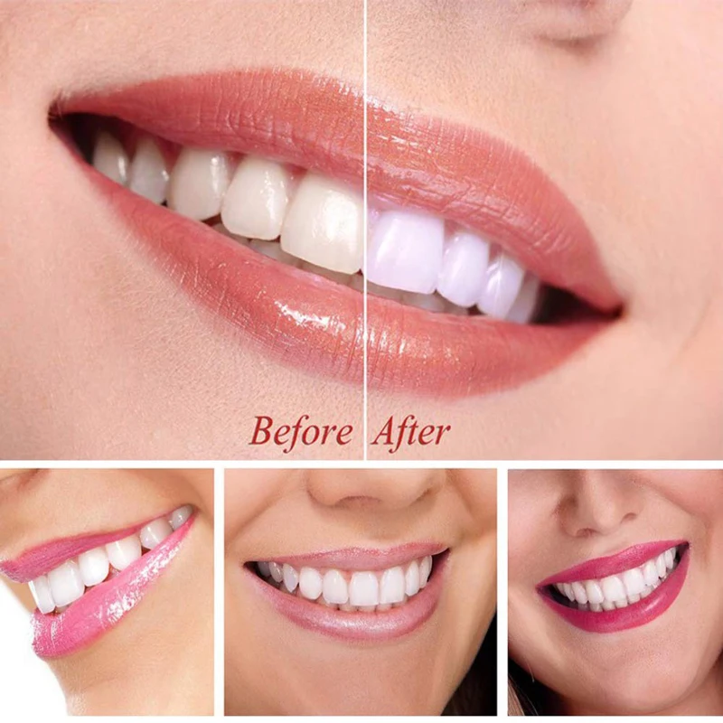 Teeth Whitening Essence Powder Gel Oral Hygiene Cleaning Teeth Care Serum Removes Plaque Stains Brighten Tooth Bleaching Tool