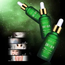 Дезодорант для тела, удаляющий запах, эссенция подмышек, запах для ног, устраняющий запах, антиперспирант, вонючий запах для ног CTN88