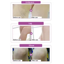 Новинка, 50 мл, Отбеливание подмышки, крем, темная кожа, красота, уход за телом, для локтя, ног, бедер, колен, личные части WSH99