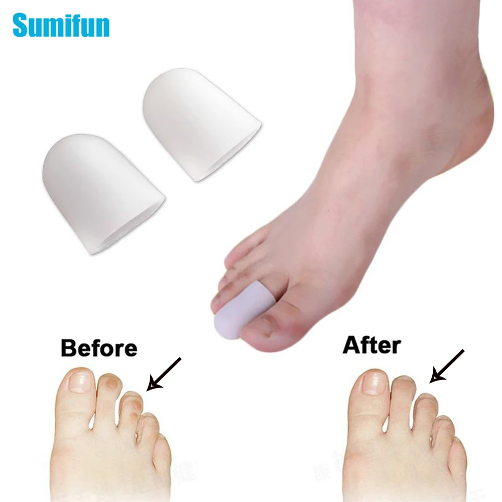 Sumifun 10 шт в упаковке новая силиконовый гель Бурсит большого пальца стопы палец