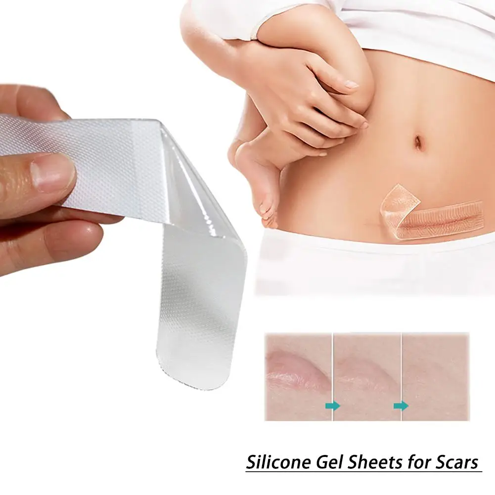 

Silicone Gel Sheets for Scars Single Sheet Scar Cover Medical Grade Scar Treatment Prevents Keloid Hypertrophic Scarring
