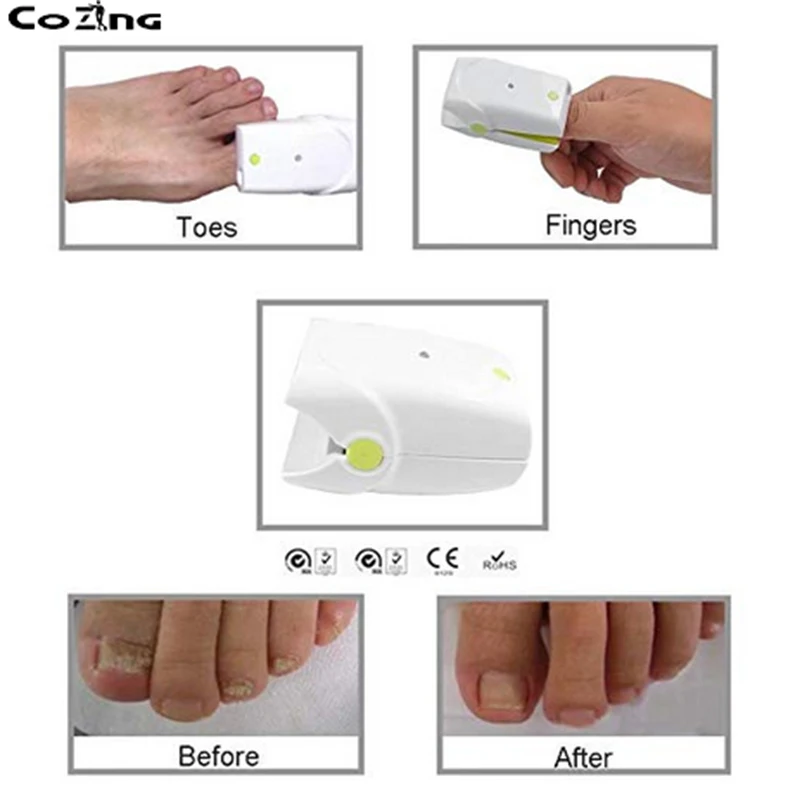 

Lllt Semiconductor Laser Therapy Device For Nail Fungus Remove Anti Fungus Treatment No Pain Rechargeable Cold Laser Soft Laser