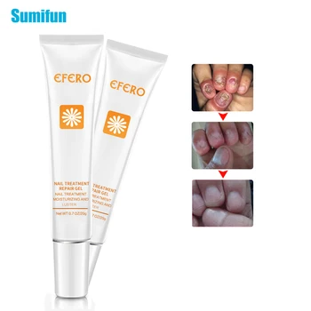 

1pcs Nail Repair Cream Anti Remove Nail Onychomycosis Paronychia Promote Nail Growth Pain Relief Herbal Ointment Foot Care P1087