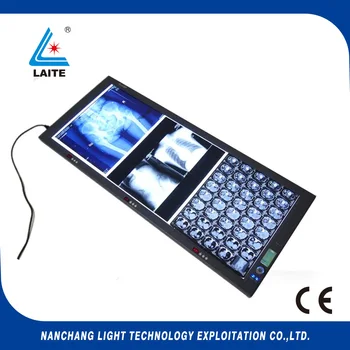 

LED Viewing Box, X Ray Viewer, Negatoscope, Medical Film Viewer triple Screen Zg-3c