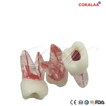 

1pc Dental Tooth Model Root Canal Rct Practice Pulp Cavity Clear Resin Teaching Teeth Model 1: 1 Dental Model Dentist Tools